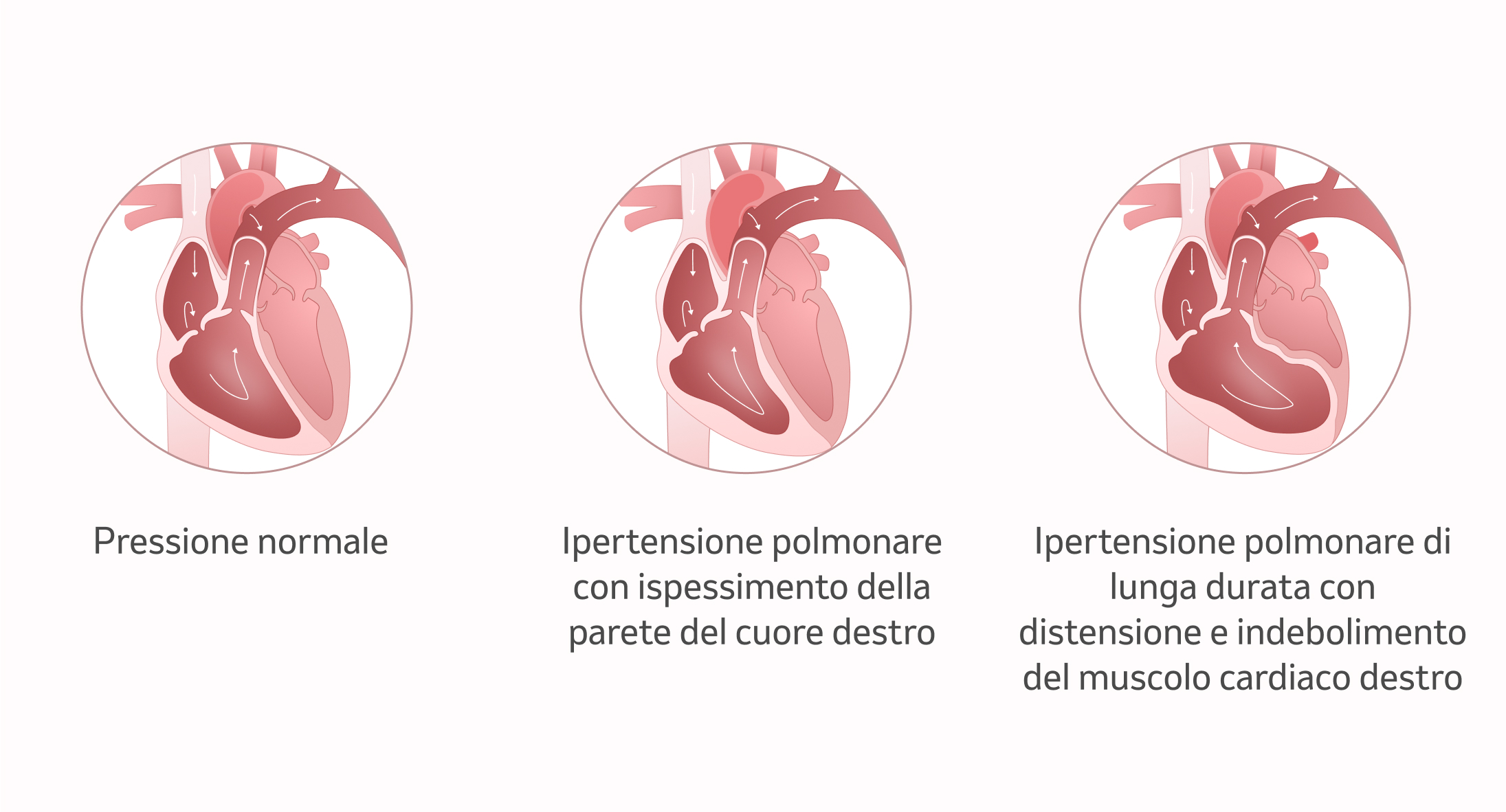 Immagine: il cuore con l'IP